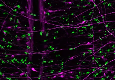 purple and green microscopic view of sea anemone neurons and stinging cells